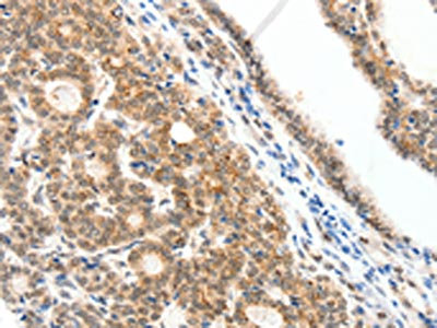 Anti-SCN2A / NaV1.2 Antibody