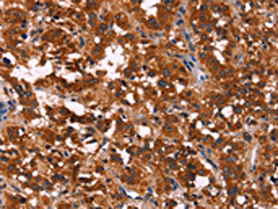 Anti-RPSA Antibody