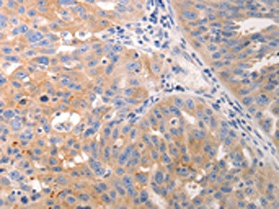 Anti-KRT6A + KRT6B + KRT6C Antibody