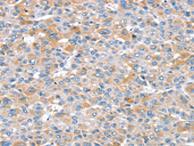 Anti-SNX25 Antibody