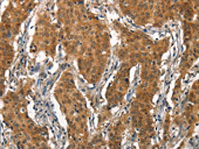 Anti-ITGA2 / CD49b Antibody