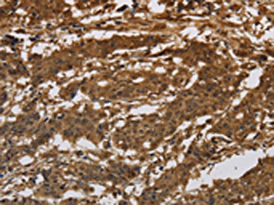 Anti-ITGB7 / Integrin beta 7 Antibody