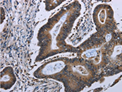Anti-ITGAE / CD103 Antibody