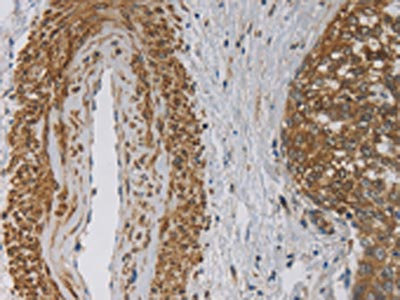 Anti-EMC8 / ER membrane protein complex subunit 8 Antibody