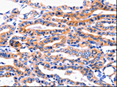 Anti-CFTR Antibody