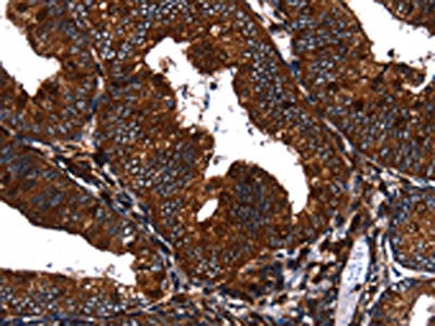 Anti-EGF / Epidermal growth factor Antibody