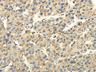 Anti-STRA6 / Receptor for retinol uptake STRA6 Antibody