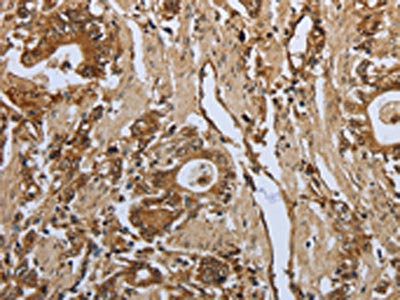 Anti-PPARA Antibody