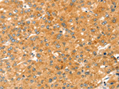 Anti-RAB27A Antibody