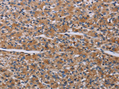 Anti-PARP4 Antibody