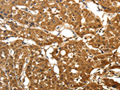 Anti-PARK7 Antibody