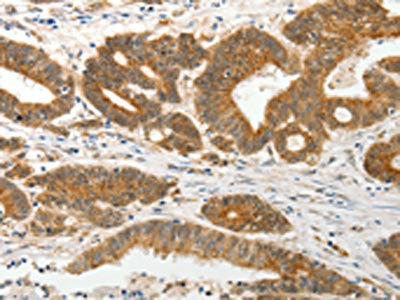 Anti-PRPH Antibody