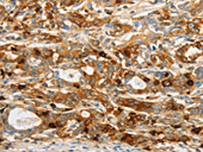 Anti-OASL Antibody