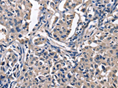 Anti-PEBP1 Antibody