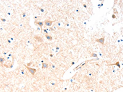 Anti-SLC19A2 Antibody
