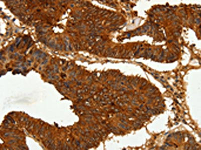Anti-CEACAM21 Antibody