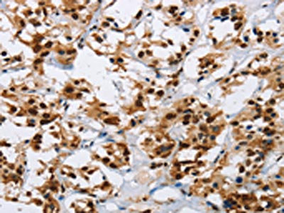 Anti-IL17C / Interleukin-17C Antibody