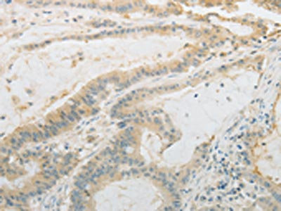 Anti-PLAU Antibody