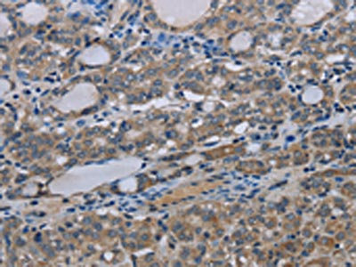 Anti-MT-ND3 Antibody