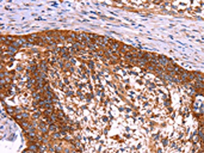 Anti-ABI1 / Abelson interactor 1 Antibody