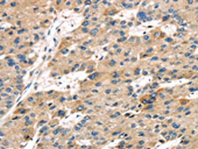 Anti-SERPINB8 Antibody