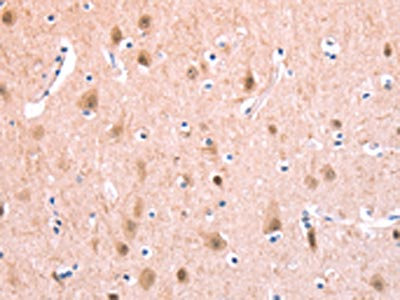 Anti-BMPR2 / Bone morphogenetic protein receptor type 2 Antibody