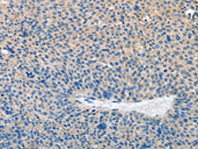 Anti-PRKG2 Antibody