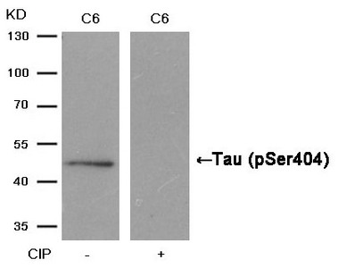 Anti-Phospho-MAPT (Ser404) / Tau Antibody
