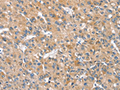 Anti-SLC25A2 Antibody