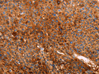 Anti-GC / Vitamin D-binding protein Antibody
