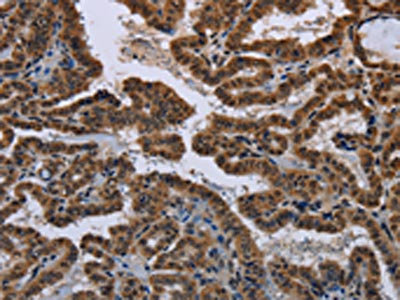 Anti-MYCN Antibody