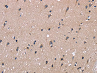 Anti-KIAA1324 / Estrogen induced gene 121 protein Antibody