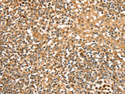 Anti-SLC8A3 Antibody