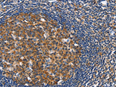 Anti-CEP97 Antibody