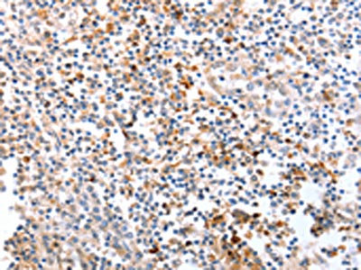 Anti-SPAG4 Antibody