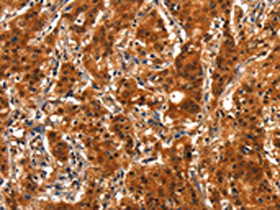 Anti-SMURF2 Antibody
