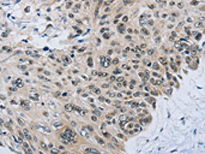 Anti-SLC16A4 Antibody