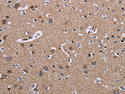 Anti-SH2D3A Antibody