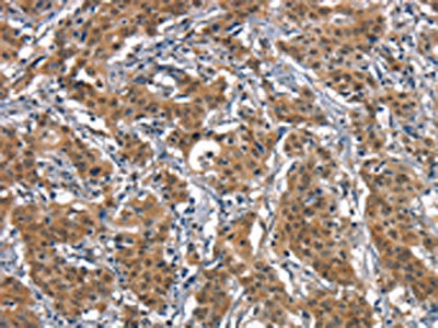 Anti-CD163 Antibody
