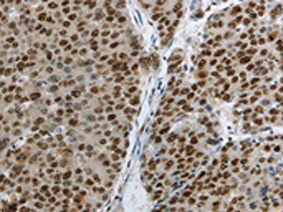 Anti-MCM3 Antibody