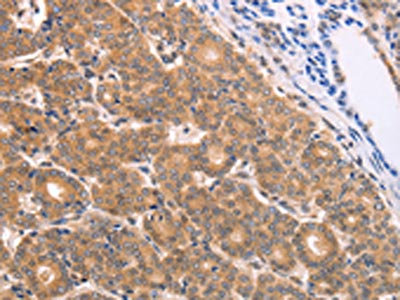 Anti-BTG3 Antibody