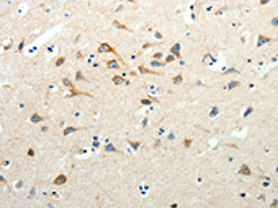 Anti-SCG3 Antibody