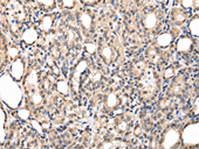 Anti-PPIL1 Antibody