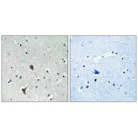 Anti-OXR1 Antibody
