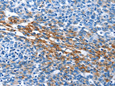 Anti-PAK6 Antibody