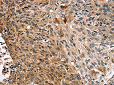 Anti-CNGA1 Antibody