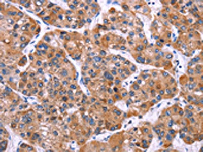 Anti-MSMO1 Antibody
