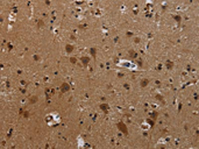 Anti-PCDHB11 Antibody