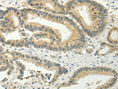Anti-SPIN4 Antibody