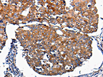 Anti-FGF2 / Fibroblast growth factor 2 Antibody